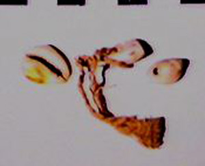 Thumbnail of Worked Cowrie Shell Fragments ()