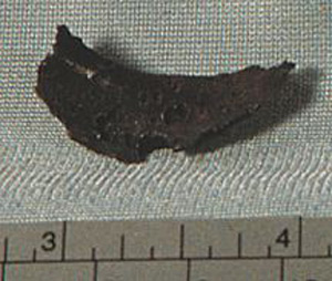 Thumbnail of Missile Fragment (1900.84.0005B)