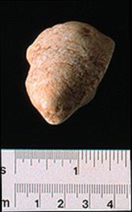 Thumbnail of Figurine Fragment, Head, "Stargazer"  (1995.02.0006)