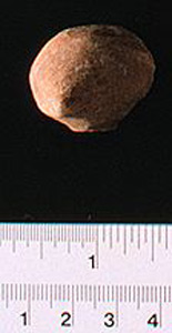 Thumbnail of Figurine Fragment, Head, "Stargazer"  (1995.02.0016)