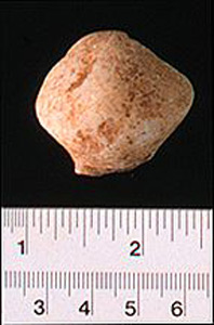 Thumbnail of Figurine Fragment, Head, "Stargazer"  (1995.02.0026)