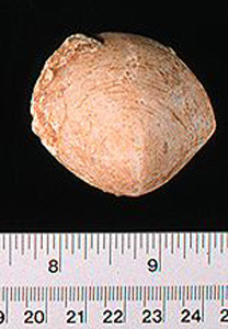 Thumbnail of Figurine Fragment, Head, "Stargazer"  (1995.02.0029)