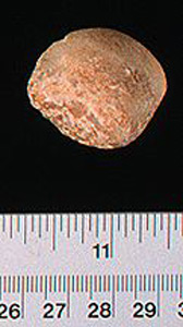 Thumbnail of Figurine Fragment, Head, "Stargazer"  (1995.02.0030)
