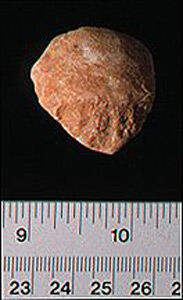 Thumbnail of Figurine Fragment, Head, "Stargazer"  (1995.02.0043)