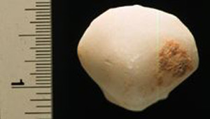 Thumbnail of Figurine Fragment: Head (1998.18.0119)