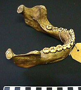 Thumbnail of Plaster Cast: Mandible of Homo heidelbergensis (1998.19.2089)
