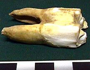 Thumbnail of Biospecimen: Faunal Remains, Tooth (1998.19.2585)