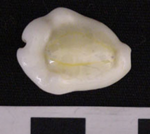 Thumbnail of Cowrie Shell (1975.21.0001A)