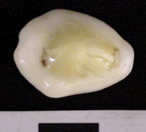 Thumbnail of Cowrie Shell ()