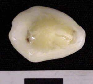 Thumbnail of Cowrie Shell (1975.21.0001B)