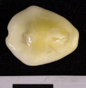 Thumbnail of Cowrie Shell (1975.21.0001F)