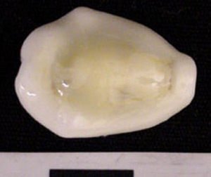 Thumbnail of Cowrie Shell (1975.21.0001G)