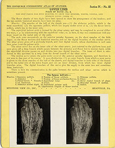 Thumbnail of Stereoscope Cards, Edinburgh Anatomy: Mediastina, Lungs, Upper Limb - Upper Limb, Palm of Hand - No. 2. (2009.10.0002AI)