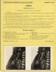 Thumbnail of Stereoscope Cards, Edinburgh Anatomy: Mediastina, Lungs, Upper Limb - Thorax, Mediastina - No. 2. (2009.10.0002E)