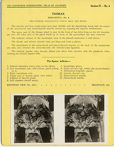 Thumbnail of Stereoscope Cards, Edinburgh Anatomy: Mediastina, Lungs, Upper Limb - Thorax, Mediastina - No. 4. (2009.10.0002G)