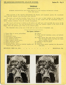 Thumbnail of Stereoscope Cards, Edinburgh Anatomy: Mediastina, Lungs, Upper Limb - Thorax, Mediastina - No. 5. (2009.10.0002H)