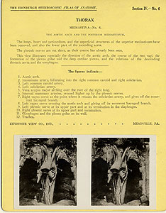 Thumbnail of Stereoscope Cards, Edinburgh Anatomy: Mediastina, Lungs, Upper Limb - Thorax, Mediastina - No. 6. (2009.10.0002I)