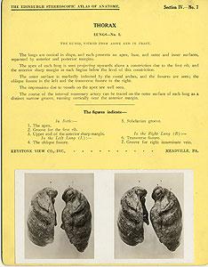 Thumbnail of Stereoscope Cards, Edinburgh Anatomy: Mediastina, Lungs, Upper Limb - Thorax, Lungs - No. 1. (2009.10.0002J)
