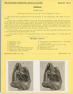 Thumbnail of Stereoscope Cards, Edinburgh Anatomy: Mediastina, Lungs, Upper Limb - Thorax, Lungs - No. 2. (2009.10.0002K)