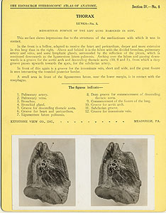 Thumbnail of Stereoscope Cards, Edinburgh Anatomy: Mediastina, Lungs, Upper Limb - Thorax, Lungs - No. 2. (2009.10.0002K)