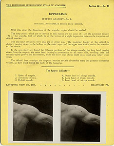 Thumbnail of Stereoscope Cards, Edinburgh Anatomy: Mediastina, Lungs, Upper Limb - Upper Limb, Surface Anatomy - No. 2. (2009.10.0002N)