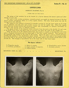Thumbnail of Stereoscope Cards, Edinburgh Anatomy: Mediastina, Lungs, Upper Limb - Upper Limb, Surface Anatomy - No. 3. (2009.10.0002O)