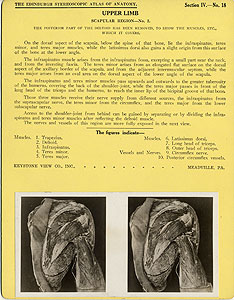 Thumbnail of Stereoscope Cards, Edinburgh Anatomy: Mediastina, Lungs, Upper Limb - Upper Limb, Scapular Region - No. 2. (2009.10.0002U)