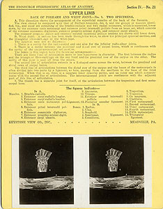 Thumbnail of Stereoscope Cards, Edinburgh Anatomy: Mediastina, Lungs, Upper Limb - Upper Limb, Back of Forearm and Wrist Joint - No. 1. (2009.10.0002X)