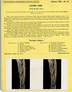 Thumbnail of Stereoscope Cards, Edinburgh Anatomy: Lower Limb Continued - Lower Limb, Back of Leg - No. 2. (2009.10.0003AA)