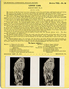 Thumbnail of Stereoscope Cards, Edinburgh Anatomy: Lower Limb Continued - Lower Limb, Sole of Foot - No. 3. (2009.10.0003AE)
