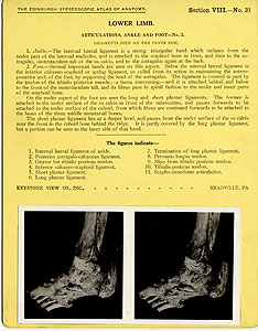 Thumbnail of Stereoscope Cards, Edinburgh Anatomy: Lower Limb Continued - Lower Limb, Articulations, Ankle and Foot - No. 2. (2009.10.0003AH)