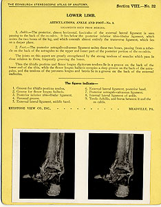 Thumbnail of Stereoscope Cards, Edinburgh Anatomy: Lower Limb Continued - Lower Limb, Articulations, Ankle and Foot - No. 3. (2009.10.0003AI)