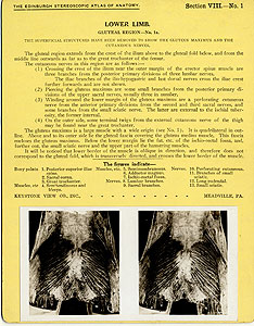 Thumbnail of Stereoscope Cards, Edinburgh Anatomy: Lower Limb Continued - Lower Limb, Gluteal Region - No. 1a. (2009.10.0003D)