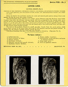 Thumbnail of Stereoscope Cards, Edinburgh Anatomy: Lower Limb Continued - Lower Limb, Gluteal Region - No. 2. (2009.10.0003F)