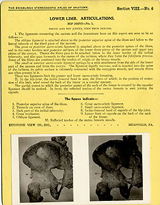 Thumbnail of Stereoscope Cards, Edinburgh Anatomy: Lower Limb Continued - Lower Limb, Articulations, Hip Joint - No. 1. (2009.10.0003I)