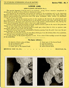 Thumbnail of Stereoscope Cards, Edinburgh Anatomy: Lower Limb Continued - Lower Limb, Articulations, Hip-Joint - No. 2. (2009.10.0003J)