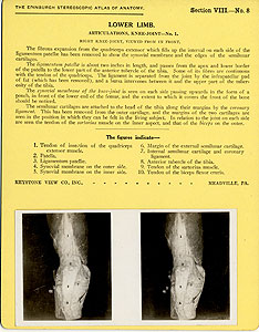 Thumbnail of Stereoscope Cards, Edinburgh Anatomy: Lower Limb Continued - Lower Limb, Articulations, Knee-Joint - No. 1. (2009.10.0003K)