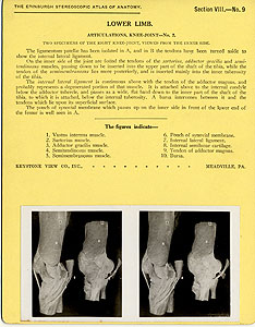 Thumbnail of Stereoscope Cards, Edinburgh Anatomy: Lower Limb Continued - Lower Limb, Articulations, Knee-Joint - No. 2. (2009.10.0003L)