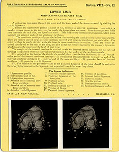 Thumbnail of Stereoscope Cards, Edinburgh Anatomy: Lower Limb Continued - Lower Limb, Articulations, Knee-Joint - No. 5. (2009.10.0003O)