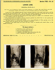 Thumbnail of Stereoscope Cards, Edinburgh Anatomy: Lower Limb Continued - Lower Limb, Popliteal Space - No. 1. (2009.10.0003P)