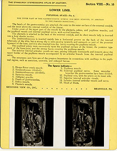 Thumbnail of Stereoscope Cards, Edinburgh Anatomy: Lower Limb Continued - Lower Limb, Popliteal Space - No. 4. (2009.10.0003S)