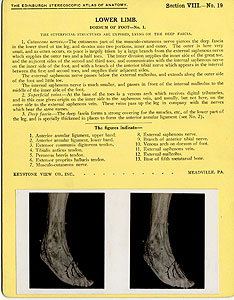 Thumbnail of Stereoscope Cards, Edinburgh Anatomy: Lower Limb Continued - Lower Limb, Dorsum of Foot - No. 1. (2009.10.0003V)