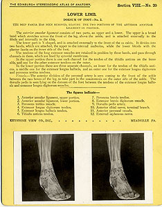 Thumbnail of Stereoscope Cards, Edinburgh Anatomy: Lower Limb Continued - Lower Limb, Dorsum of Foot - No. 2. (2009.10.0003W)