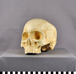 Thumbnail of Plaster Cast: Chinese Skull (1998.19.2091A)
