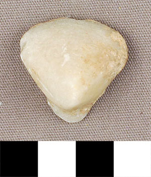 Thumbnail of Figurine Fragment, Head, "Stargazer"  (2000.17.0152)