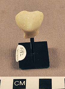 Thumbnail of Figurine Fragment, Head, "Stargazer"  (2000.17.0182)