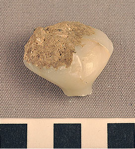 Thumbnail of Figurine Fragment, Head, "Stargazer"  (2002.14.0032)